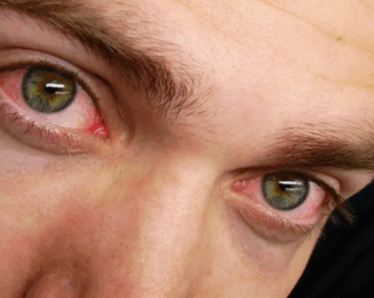 Capture decran 2025 07 09 050019 Pourquoi faut-il dormir au moins 6 heures par nuit ?