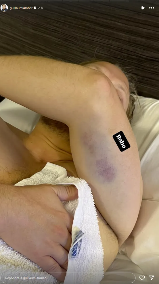 Guillaume Lambert dévoile des images troublantes après un grave accident sur scène 2 Guillaume Lambert dévoile des images troublantes après un grave accident sur scène Capture decran 2025 07 13 154338 Guillaume Lambert dévoile des images troublantes après un grave accident sur scène