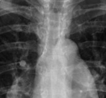 Ce poison quotidien qui fragilise vos os sans que vous le sachiez 3 Ce poison quotidien qui fragilise vos os sans que vous le sachiez Capture decran 2025 07 14 041649 Ce poison quotidien qui fragilise vos os sans que vous le sachiez