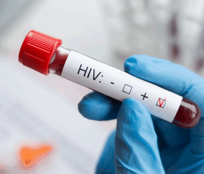 Capture decran 2025 08 08 052743 4.200 patients appelés à se faire dépister après une grave erreur dans un service dentaire