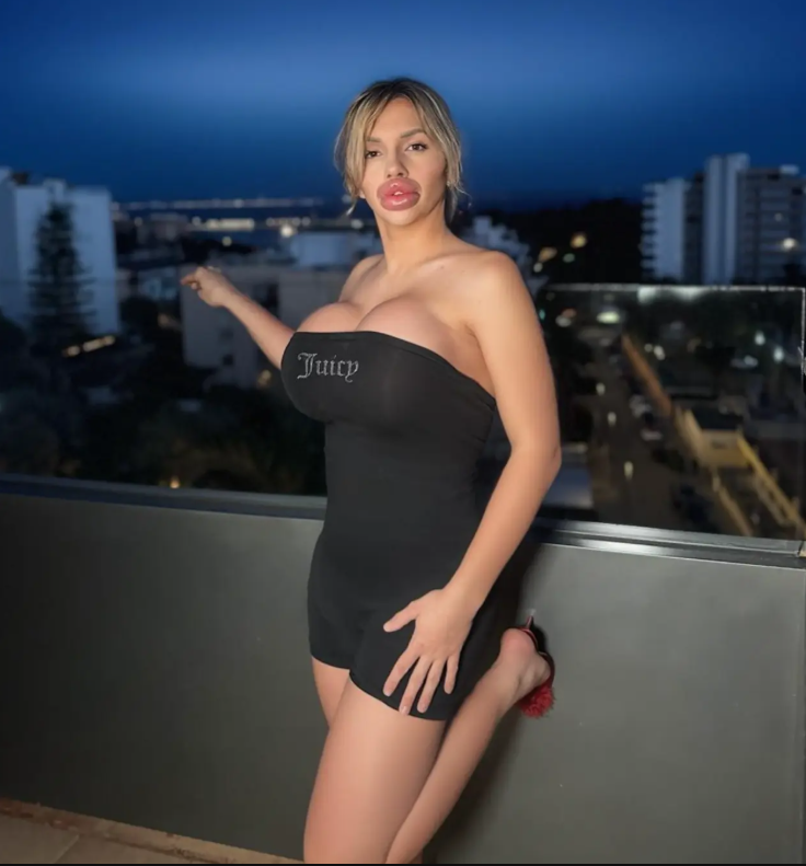 Capture decran 2025 08 15 064821 L’influenceuse aux lèvres XXL qui ne peut plus les fermer choque et fascine