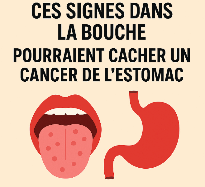 Capture decran 2025 08 19 045036 1 Ces signes dans la bouche pourraient cacher un cancer de l’estomac