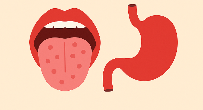 Ces signes dans la bouche pourraient cacher un cancer de l’estomac 1 Ces signes dans la bouche pourraient cacher un cancer de l’estomac Capture decran 2025 08 19 045036 1 e1755594883677 Ces signes dans la bouche pourraient cacher un cancer de l’estomac