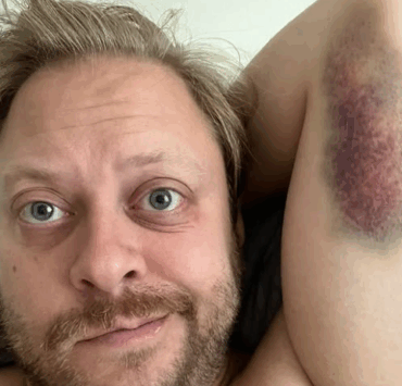 Guillaume Lambert se fait tatouer… pour marquer ses blessures ! Et il ne fait pas les choses à moitié ! 5 Guillaume Lambert se fait tatouer… pour marquer ses blessures ! Et il ne fait pas les choses à moitié ! Capture decran 2025 08 22 142704 Guillaume Lambert se fait tatouer… pour marquer ses blessures ! Et il ne fait pas les choses à moitié !