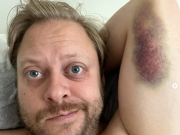 Guillaume Lambert se fait tatouer… pour marquer ses blessures ! Et il ne fait pas les choses à moitié ! 1 Guillaume Lambert se fait tatouer… pour marquer ses blessures ! Et il ne fait pas les choses à moitié ! Capture decran 2025 08 22 142704 Guillaume Lambert se fait tatouer… pour marquer ses blessures ! Et il ne fait pas les choses à moitié !