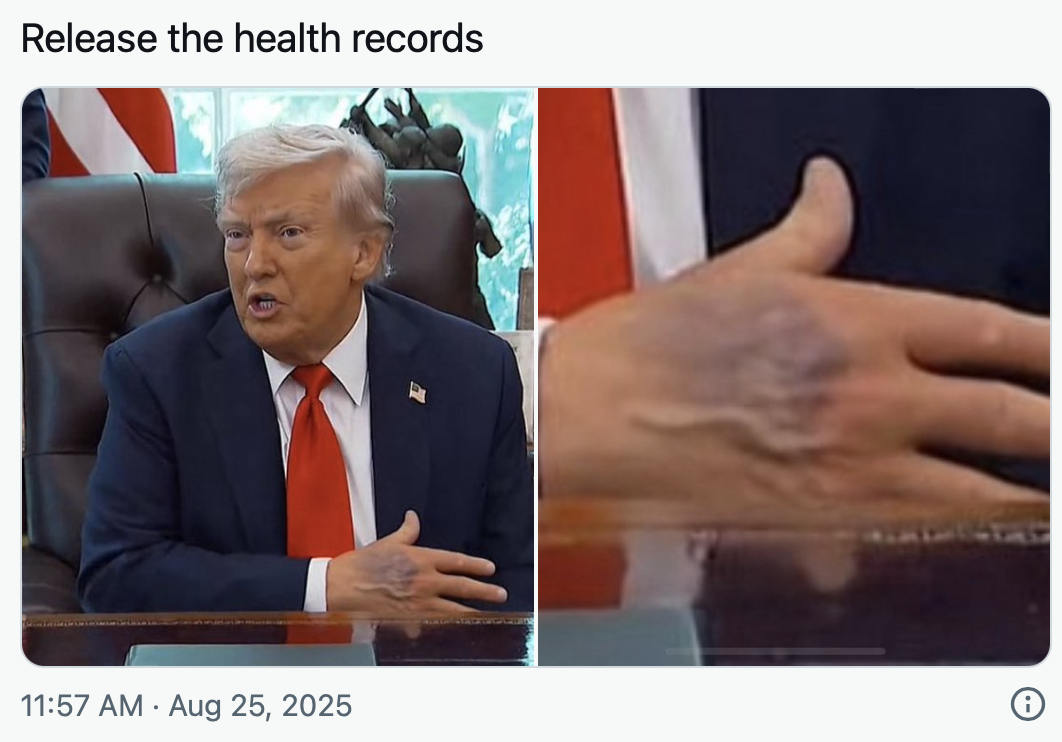 Des images récentes de la main de Donald Trump suscitent de vives réactions 2 Des images récentes de la main de Donald Trump suscitent de vives réactions Capture decran le 2025 08 26 a 10.02.13 Des images récentes de la main de Donald Trump suscitent de vives réactions