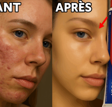 Pourquoi l’astuce du dentifrice et citron fait autant jaser ? 4 Pourquoi l’astuce du dentifrice et citron fait autant jaser ? dentiff Pourquoi l’astuce du dentifrice et citron fait autant jaser ?