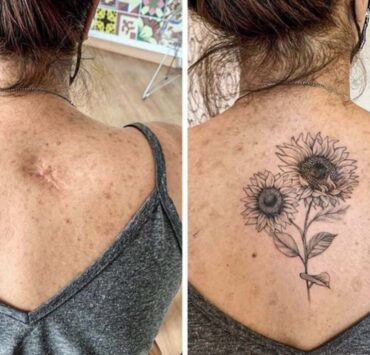 Tatouage cicatrice : quand l’art transforme les blessures en beauté 4 Tatouage cicatrice : quand l’art transforme les blessures en beauté Tatouage cicatrice : quand l’art transforme les blessures en beauté