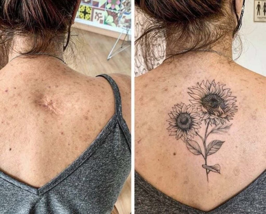 Tatouage cicatrice : quand l’art transforme les blessures en beauté 1 Tatouage cicatrice : quand l’art transforme les blessures en beauté Tatouage cicatrice : quand l’art transforme les blessures en beauté