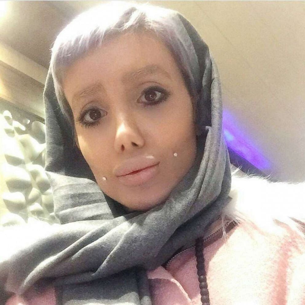 Le vrai visage du « sosie raté d’Angelina Jolie » : ce que Sahar Tabar a révélé au monde 1 Le vrai visage du « sosie raté d’Angelina Jolie » : ce que Sahar Tabar a révélé au monde Le vrai visage du « sosie raté d’Angelina Jolie » : ce que Sahar Tabar a révélé au monde
