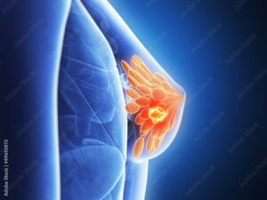 💜 Cancer du foie :⚠️ 60 % des cas découverts trop tard — les symptômes discrets à ne jamais ignorer 2 💜 Cancer du foie :⚠️ 60 % des cas découverts trop tard — les symptômes discrets à ne jamais ignorer 1000 F 49610873 V6eDMDLBIosPyTBf4V9jv4AU3ugvt1nF 💜 Cancer du foie :⚠️ 60 % des cas découverts trop tard — les symptômes discrets à ne jamais ignorer
