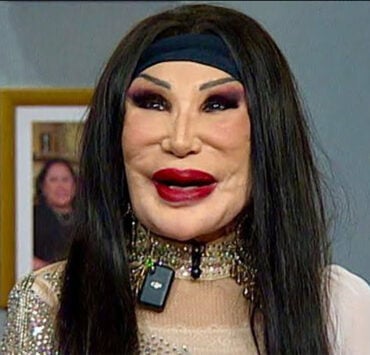 Elle a tourné dans plus de 100 films, mais une erreur médicale a changé son visage pour toujours 2 Elle a tourné dans plus de 100 films, mais une erreur médicale a changé son visage pour toujours 571132594 1243292347835338 7386223729741010030 n Elle a tourné dans plus de 100 films, mais une erreur médicale a changé son visage pour toujours