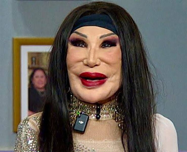 571132594 1243292347835338 7386223729741010030 n Elle a tourné dans plus de 100 films, mais une erreur médicale a changé son visage pour toujours