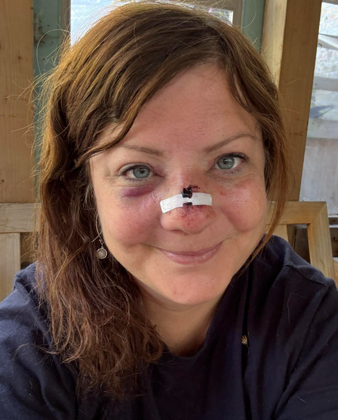 Capture decran 2025 10 04 123426 1 Marie-Annick Lépine transportée par une ambulancière après un incident