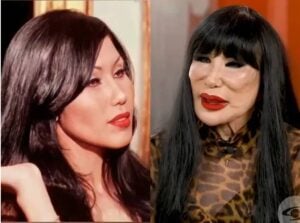 Elle a tourné dans plus de 100 films, mais une erreur médicale a changé son visage pour toujours 3 Elle a tourné dans plus de 100 films, mais une erreur médicale a changé son visage pour toujours Capture decran 24 10 2025 12014 www.astucesantemag.com Elle a tourné dans plus de 100 films, mais une erreur médicale a changé son visage pour toujours