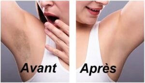 Éclaircir naturellement ses aisselles : l’astuce étonnante au dentifrice que tout le monde a chez soi 2 Éclaircir naturellement ses aisselles : l’astuce étonnante au dentifrice que tout le monde a chez soi Capture decran 26 10 2025 104744 www.astucesantemag.com Éclaircir naturellement ses aisselles : l’astuce étonnante au dentifrice que tout le monde a chez soi