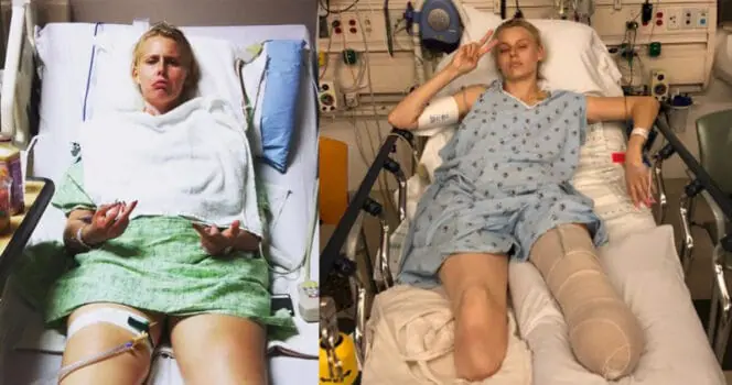 Privée de ses jambes à cause d’un tampon, Lauren Wasser devient symbole de résilience 1 Privée de ses jambes à cause d’un tampon, Lauren Wasser devient symbole de résilience Lauren Wasser.jpg Privée de ses jambes à cause d’un tampon, Lauren Wasser devient symbole de résilience