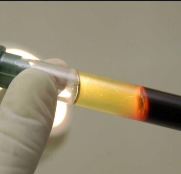 « Mauvais » cholestérol : la clé génétique derrière son accumulation enfin découverte 5 « Mauvais » cholestérol : la clé génétique derrière son accumulation enfin découverte cover r4x3w1200 675ab97b18fab sipa 00518293 000004 « Mauvais » cholestérol : la clé génétique derrière son accumulation enfin découverte