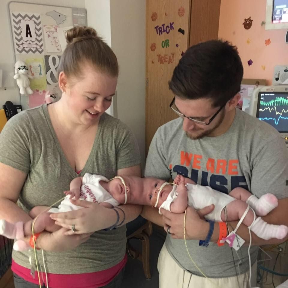 Elles étaient siamoises et leur transformation fait halluciner tout le monde 2 Elles étaient siamoises et leur transformation fait halluciner tout le monde 1341900 w960h960cx467cy608 1 Elles étaient siamoises et leur transformation fait halluciner tout le monde