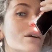 Capture decran 2025 11 14 162242 Paris Jackson choque le web en révélant le trou causé par la drogue dans sa cloison nasale