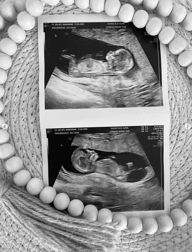 Après une épreuve tragique, Marianne St-Gelais révèle un miracle familial ! 3 Après une épreuve tragique, Marianne St-Gelais révèle un miracle familial ! Capture decran 2025 11 19 131746 Après une épreuve tragique, Marianne St-Gelais révèle un miracle familial !