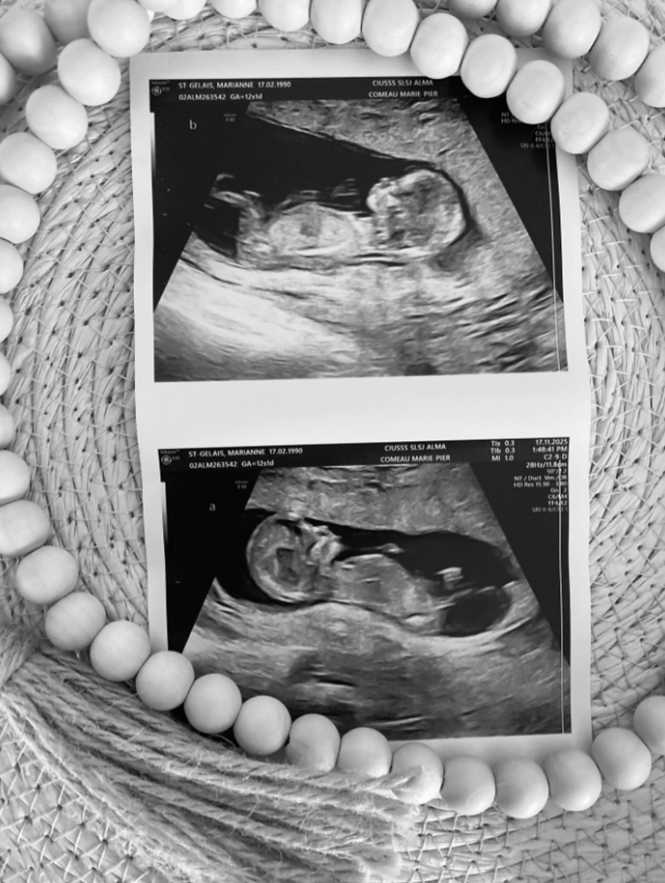 Capture decran 2025 11 20 134519 Découvrez toutes les photos de Noé, le fils de Marianne St-Gelais — qui attend maintenant des jumeaux !