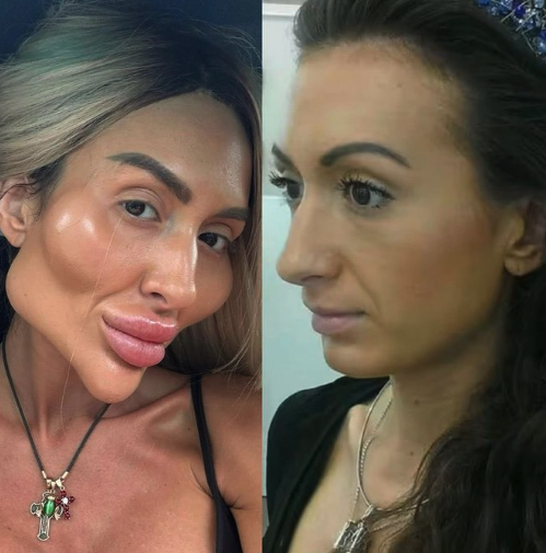 Tu ne croiras JAMAIS à quoi elle ressemblait avant 2 Tu ne croiras JAMAIS à quoi elle ressemblait avant Capture decran le 2025 11 03 a 16.40.05 Tu ne croiras JAMAIS à quoi elle ressemblait avant