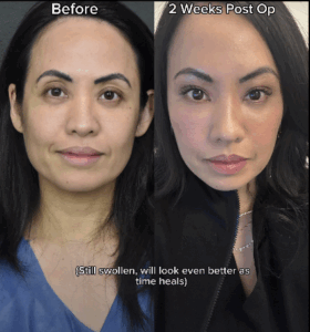 Ce chirurgien TikTok fait exploser le web en dévoilant les supposées chirurgies secrètes des stars 4 Ce chirurgien TikTok fait exploser le web en dévoilant les supposées chirurgies secrètes des stars Capture decran le 2025 11 20 a 01.29.19 Ce chirurgien TikTok fait exploser le web en dévoilant les supposées chirurgies secrètes des stars