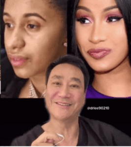 Ce chirurgien TikTok fait exploser le web en dévoilant les supposées chirurgies secrètes des stars 3 Ce chirurgien TikTok fait exploser le web en dévoilant les supposées chirurgies secrètes des stars Capture decran le 2025 11 20 a 01.29.45 Ce chirurgien TikTok fait exploser le web en dévoilant les supposées chirurgies secrètes des stars