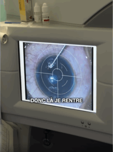 Capture decran le 2025 11 22 a 19.59.38 Changer la couleur de ses yeux pour 7 000 $ : le choix extrême d’un jeune obsédé par son image