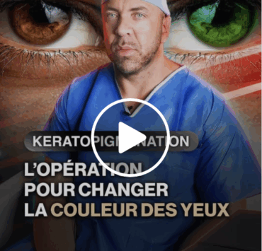 Capture decran le 2025 11 22 a 23.32.48 e1763872487435 Changer la couleur de ses yeux pour 7 000 $ : le choix extrême d’un jeune obsédé par son image