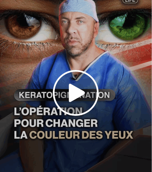 Capture decran le 2025 11 22 a 23.32.48 e1763872487435 Changer la couleur de ses yeux pour 7 000 $ : le choix extrême d’un jeune obsédé par son image