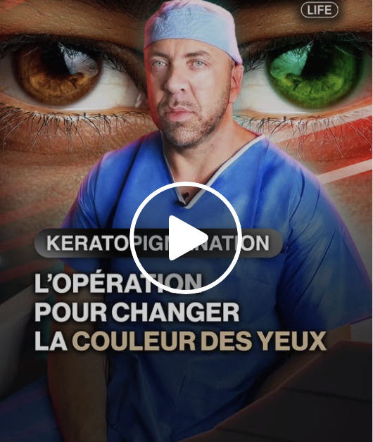 Capture decran le 2025 11 22 a 23.32.48 e1763872487435 Changer la couleur de ses yeux pour 7 000 $ : le choix extrême d’un jeune obsédé par son image