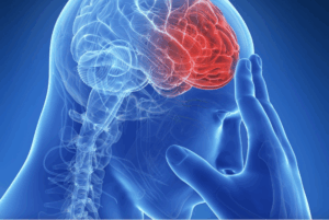 Capture decran le 2025 11 25 a 03.55.22 1 mois avant AVC vous recevez des signaux de votre Corps : les 7 signes à connaître absolument