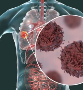 Capture decran 10 11 2025 221946 tncancer.com 10 habitudes étonnantes qui augmentent vos risques de cancer