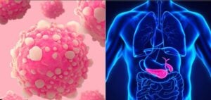 Capture decran 10 11 2025 222517 healtharticlesmagazine.com 10 habitudes étonnantes qui augmentent vos risques de cancer