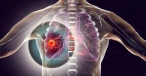 Capture decran 10 11 2025 222657 www.bing .com 10 habitudes étonnantes qui augmentent vos risques de cancer