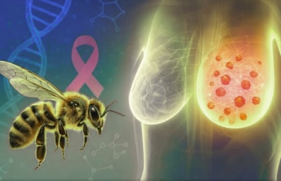 Capture decran 11 11 2025 215243 www.facebook.com Le venin d’abeille détruit 100 % des cellules cancéreuses du sein les plus agressives en une heure