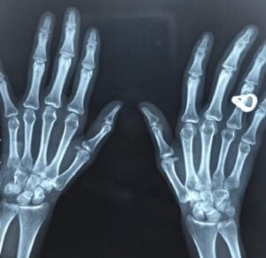 Des milliers de personnes se font implanter des micropuces pour remplacer les clés, les cartes et les documents personnels. 2 Des milliers de personnes se font implanter des micropuces pour remplacer les clés, les cartes et les documents personnels. Capture decran 11 11 2025 22421 www.bing .com Des milliers de personnes se font implanter des micropuces pour remplacer les clés, les cartes et les documents personnels.