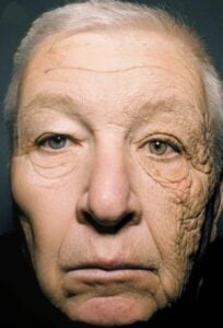 Capture decran 12 11 2025 23110 www.facebook.com L’effet du soleil sur le visage d’un chauffeur de camion après 28 ans au volant