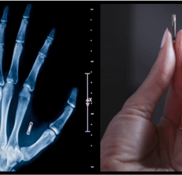 JSE3 e1762919386393 Des milliers de personnes se font implanter des micropuces pour remplacer les clés, les cartes et les documents personnels.