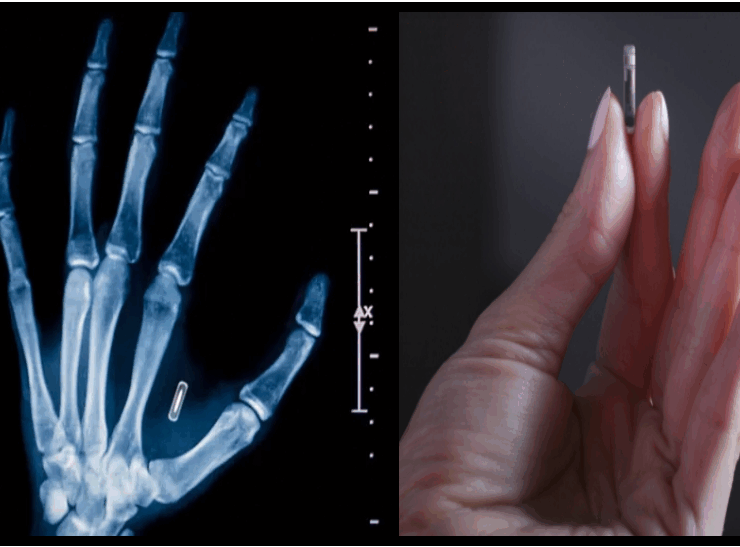 JSE3 e1762919386393 Des milliers de personnes se font implanter des micropuces pour remplacer les clés, les cartes et les documents personnels.