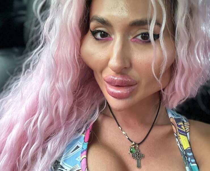 anastasiia pokreshchuk tem mais de 100 mil seguidores no instagram ela publica registros da vida na plataforma 1691080461065 v2 4x3 Tu ne croiras JAMAIS à quoi elle ressemblait avant