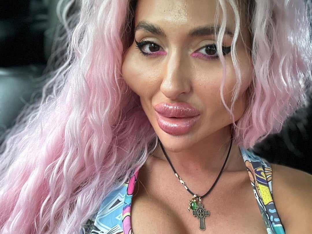 anastasiia pokreshchuk tem mais de 100 mil seguidores no instagram ela publica registros da vida na plataforma Tu ne croiras JAMAIS à quoi elle ressemblait avant