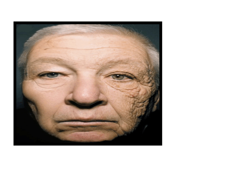 ee L’effet du soleil sur le visage d’un chauffeur de camion après 28 ans au volant