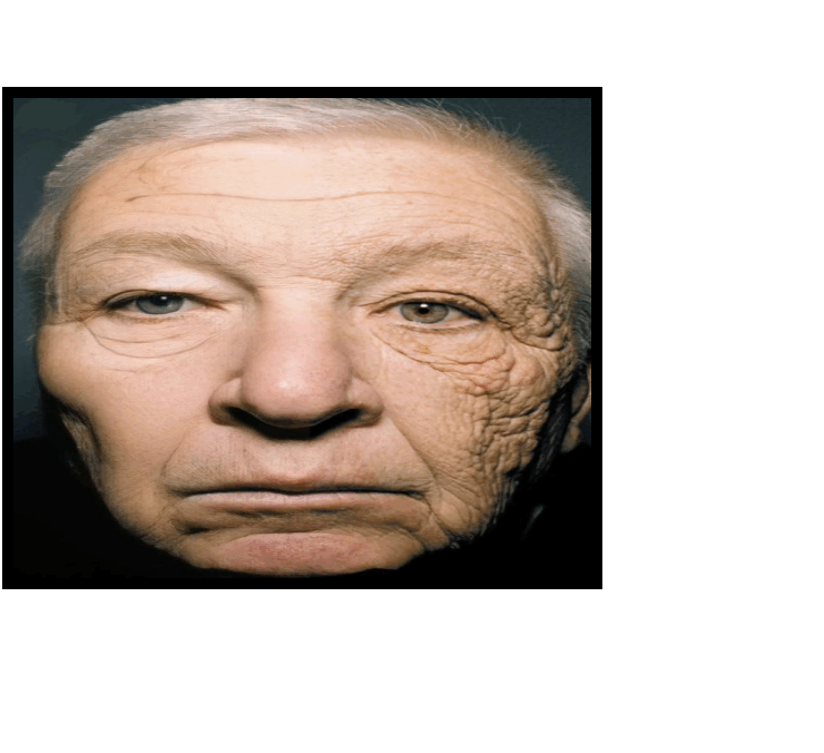 ee L’effet du soleil sur le visage d’un chauffeur de camion après 28 ans au volant