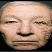 ee e1763007626643 L’effet du soleil sur le visage d’un chauffeur de camion après 28 ans au volant