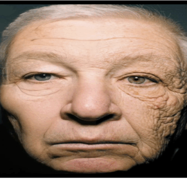 ee e1763007626643 L’effet du soleil sur le visage d’un chauffeur de camion après 28 ans au volant