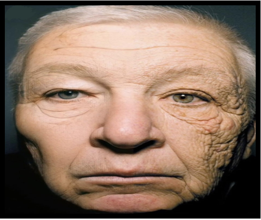 ee e1763007626643 L’effet du soleil sur le visage d’un chauffeur de camion après 28 ans au volant