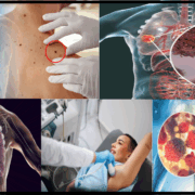 jd 10 habitudes étonnantes qui augmentent vos risques de cancer